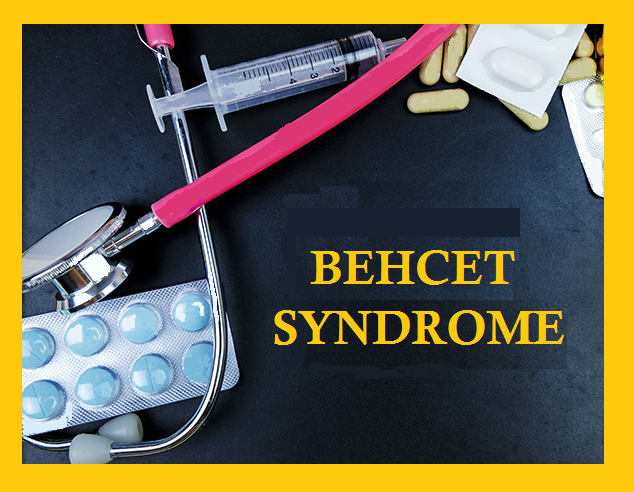 BEHCET SYNDROME