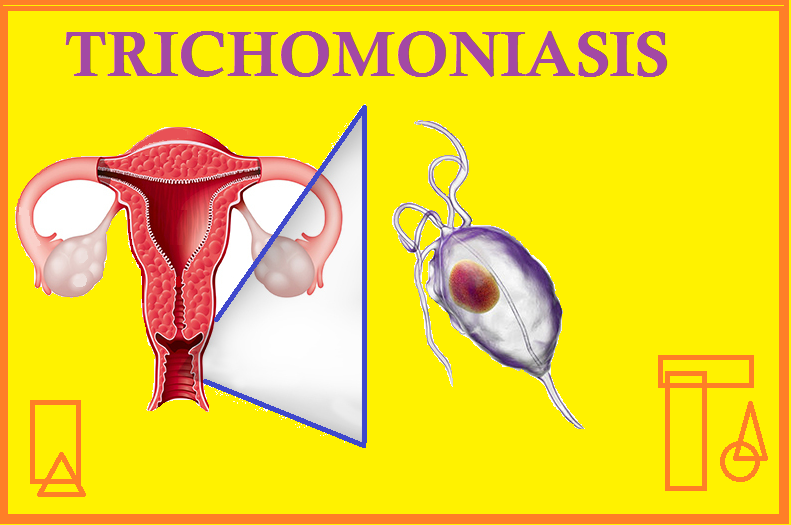 trichomoniasis