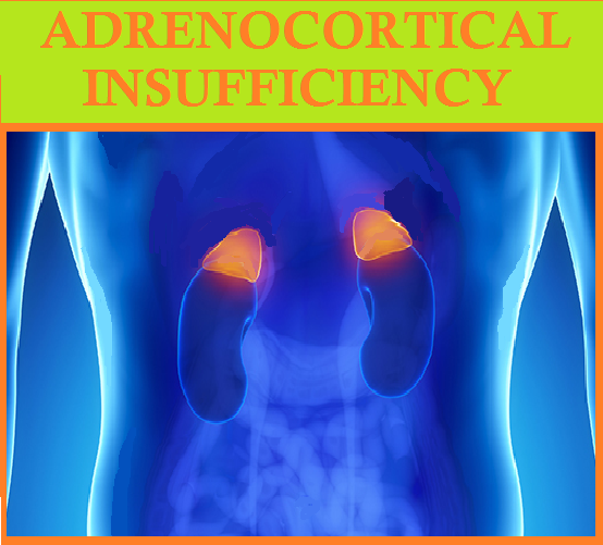 ACUTE ADRENOCORTICAL INSUFFICIENCY (Adrenal Crisis)